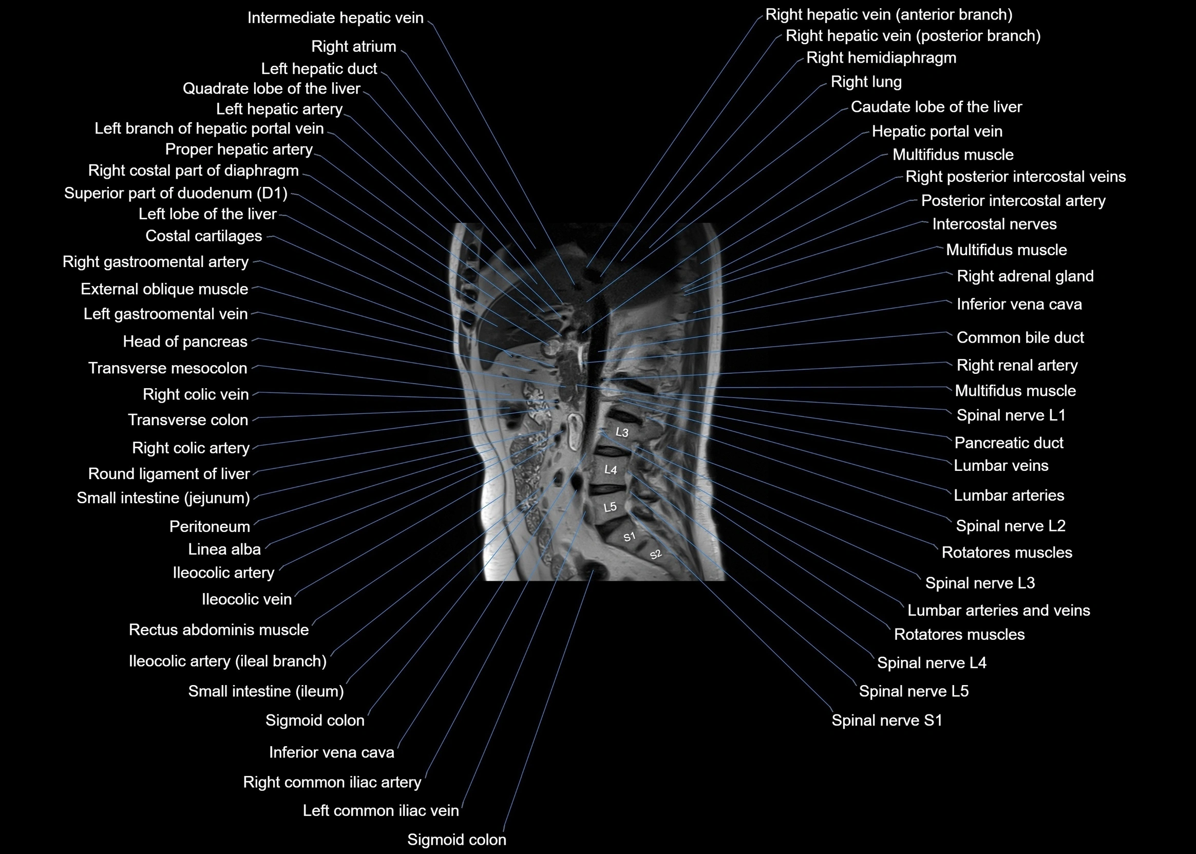 MRI abdomen sagittal cross sectional anatomy  radiology  image-img-00001-00033.webp